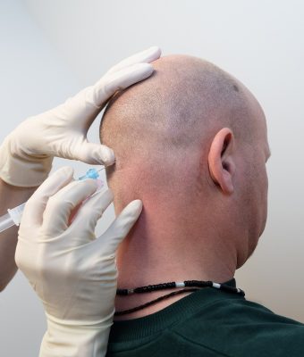 clusterhoofdpijn behandeling