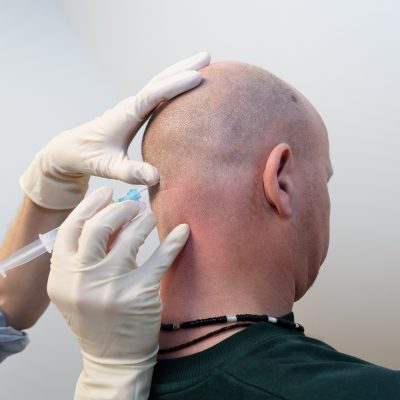 clusterhoofdpijn behandeling