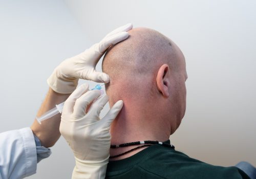 clusterhoofdpijn behandeling